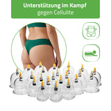 HABYS Feuerlose chinesische Vakuum-Schröpfköpfe mit Pumpe | 24 Stück